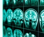How is AI Used in Medical Imaging?