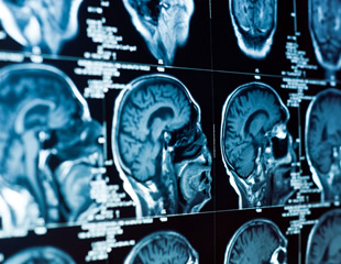 The Hidden Infrastructure Cost Behind Every AI Answer