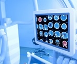 Industrial Leaders Go “All-In” on AI, Enterprise Monitoring, and Human-Centric Innovation at Seeq Conneqt 2025