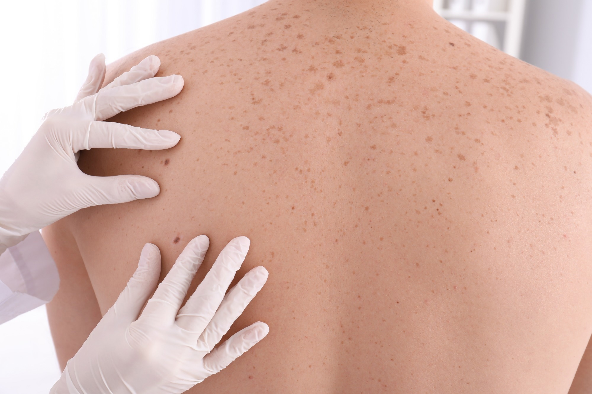 Study: Enhancing Healthcare Resilience: A Novel Approach to Smart Skin Screening Apps. Image credit: New Africa/Shutterstock