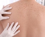 Enhancing Healthcare Resilience: A Novel Approach to Smart Skin Screening Apps