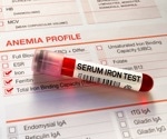 AI's Potential in Revolutionizing Iron Disorder Management