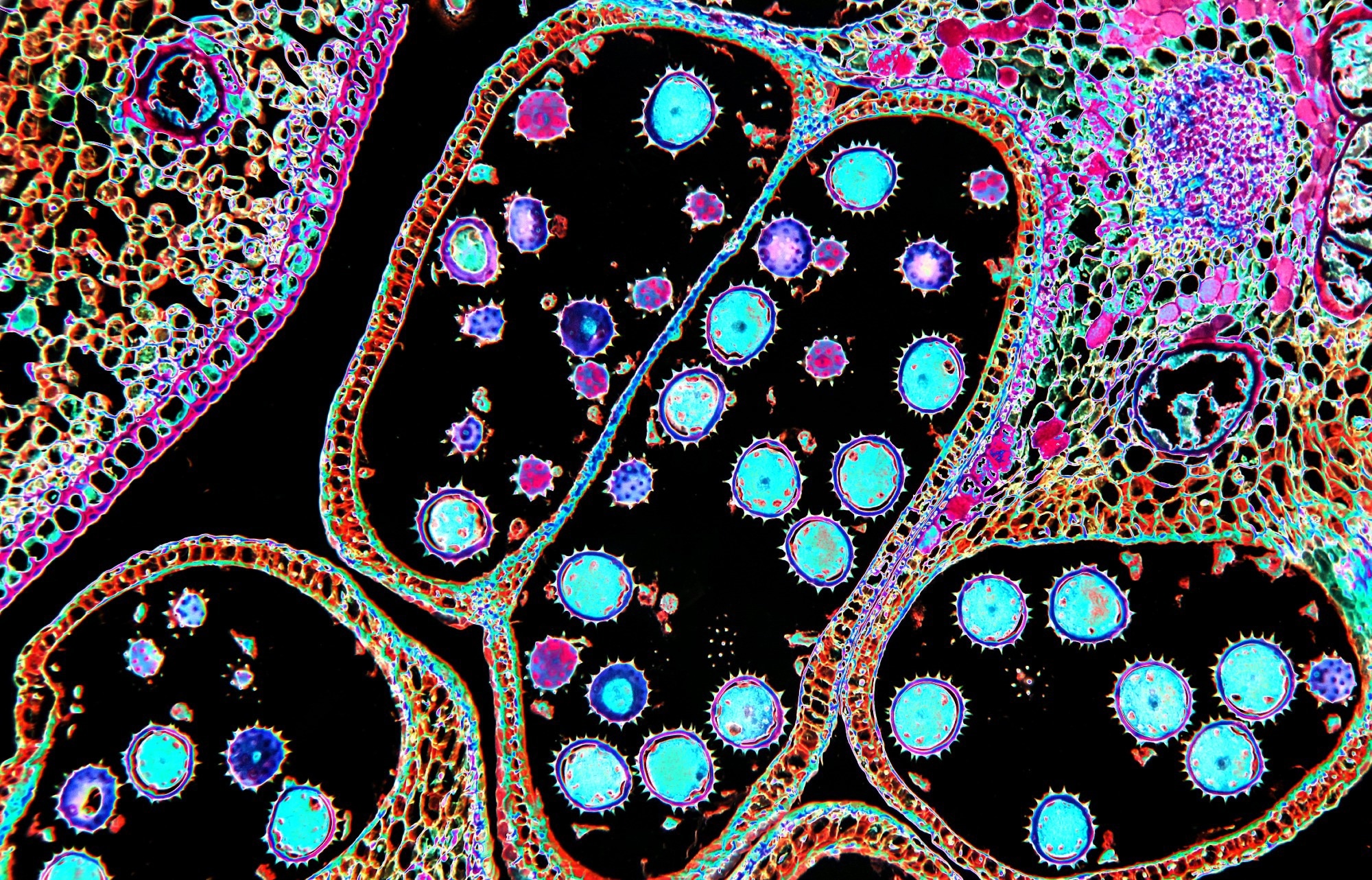 Study: Non-Invasive Microscopy in Complex Environments Using Overlapping Speckle Correlation Algorithm. Image credit: Jubal Harshaw/Shutterstock.