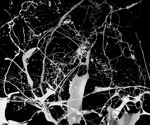 Metamodeling Neuronal Networks: Power Spectra Estimation and Parameter Inference