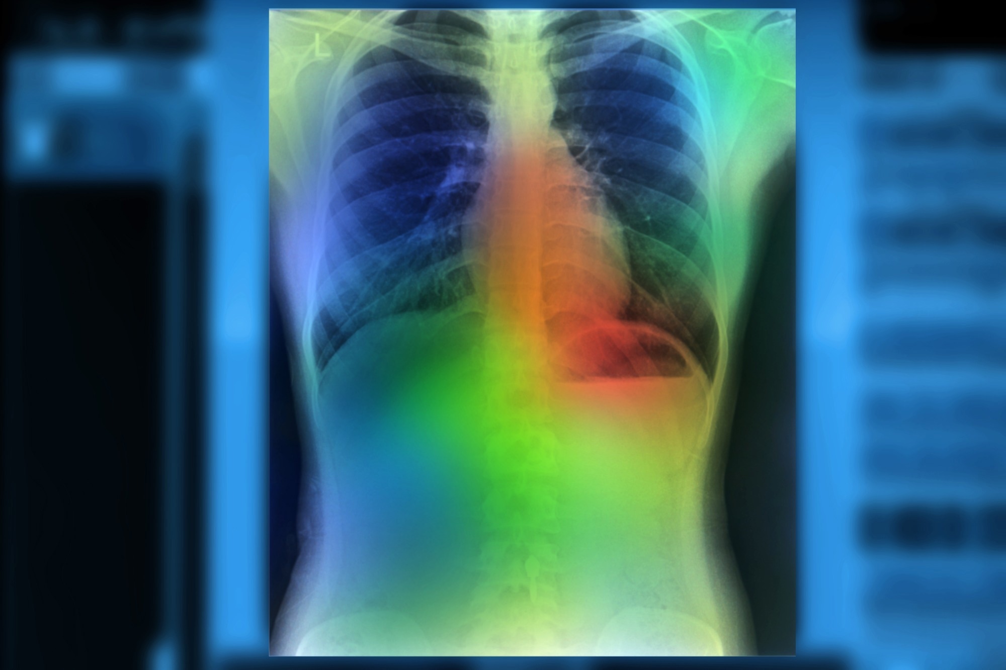 Study: Artificial intelligence-based model to classify cardiac functions from chest radiographs: a multi-institutional, retrospective model development and validation study. Image Credit: Zapp2Photo / Shutterstock