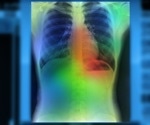 Heartwarming Breakthrough: Scientists Use AI to Pinpoint Valvular Heart Disease with Unprecedented Accuracy