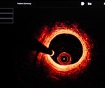 AI-Driven Optical Tomography via Multi-Core Fiber-Optic Rotation