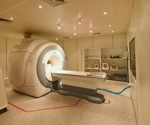 Enhancing MRI Safety: Deep Learning for Motion Artifact Detection