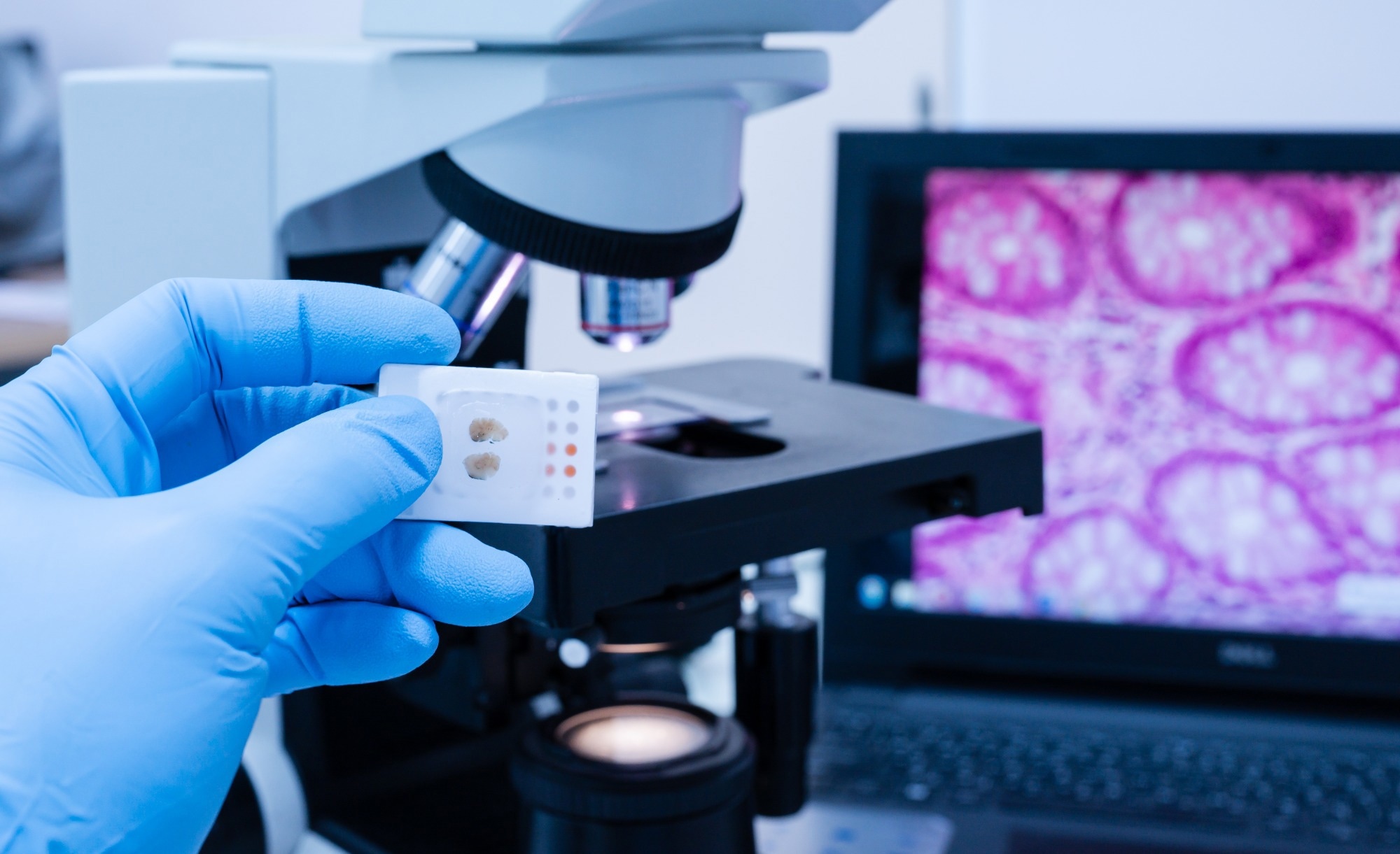 Study: WSInfer: Empowering Digital Pathology with Open-Source Deep Learning. Image credit:  Komsan Loonprom/Shutterstock