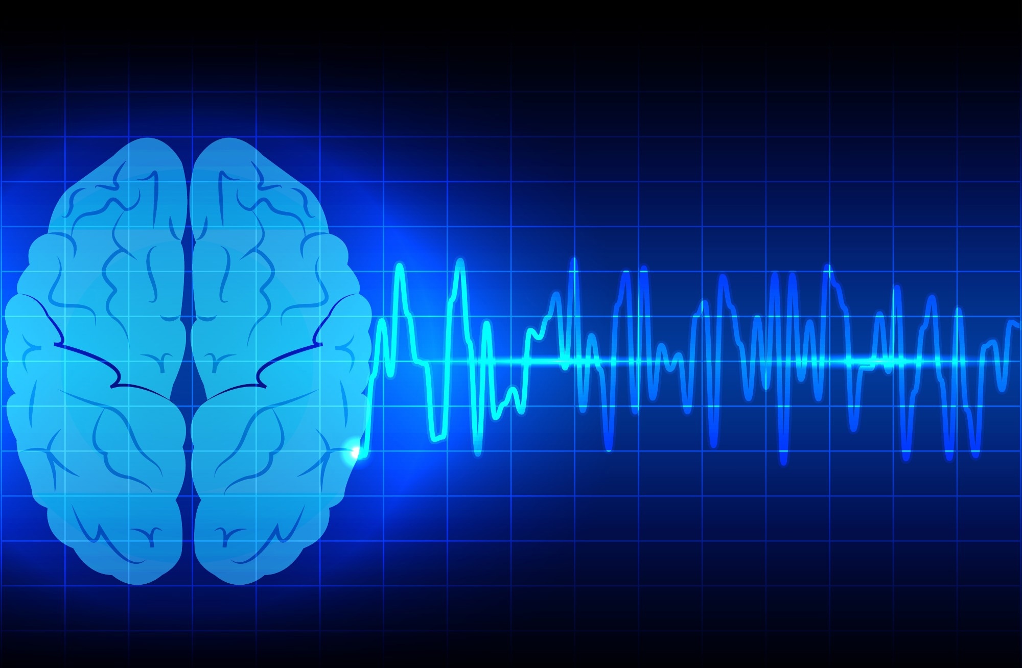 Study: ReAInet: Bridging Artificial and Human Vision through EEG-Aligned Neural Networks. Image credit: Mrspopman1985/Shutterstock