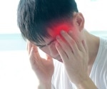 Machine Learning Models for Classification of Migraine Headaches