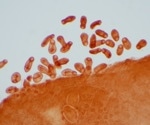 Deep Learning Revolutionizes Parasitic Organism Detection
