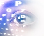 Harnessing AI in Primary Care to Advance Glaucoma Detection