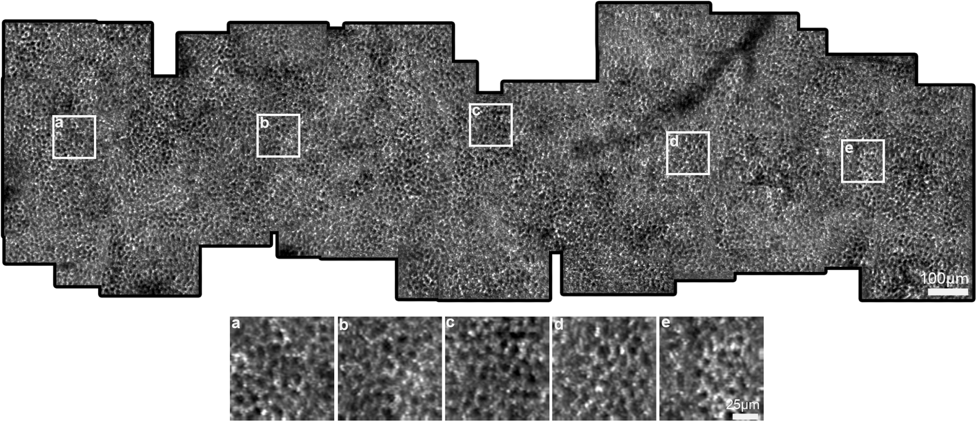 The image shows the visualization of the RPE mosaic using the P-GAN recovered images (this montage was manually constructed from up to 63 overlapping recovered RPE images from the left eye of participant S2). The white squares (a–e) indicate regions that are further magnified for better visualization at retinal locations a 0.3 mm, b 0.8 mm, c 1.3 mm, d 1.7 mm, and e 2.4 mm temporal to the fovea, respectively. Additional examples of montages from two additional participants are shown in Supplementary Fig. 5. https://www.nature.com/articles/s43856-024-00483-1