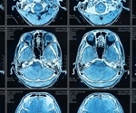 Revolutionizing Medical Imaging: Monash University Unveils AI Algorithm for Second Opinions, Boosting Accuracy and Efficiency