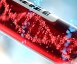 Accessible AI Solution Improves Immunotherapy Success Rates