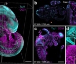 AI Revolutionizes Microscopy by Sharpening Deep Tissue Images