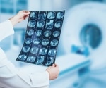 AI Model MUSK Revolutionizes Cancer Prognosis and Treatment Guidance