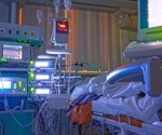 Explainable AI Transforms ICU Decision-Making and Patient Outcomes