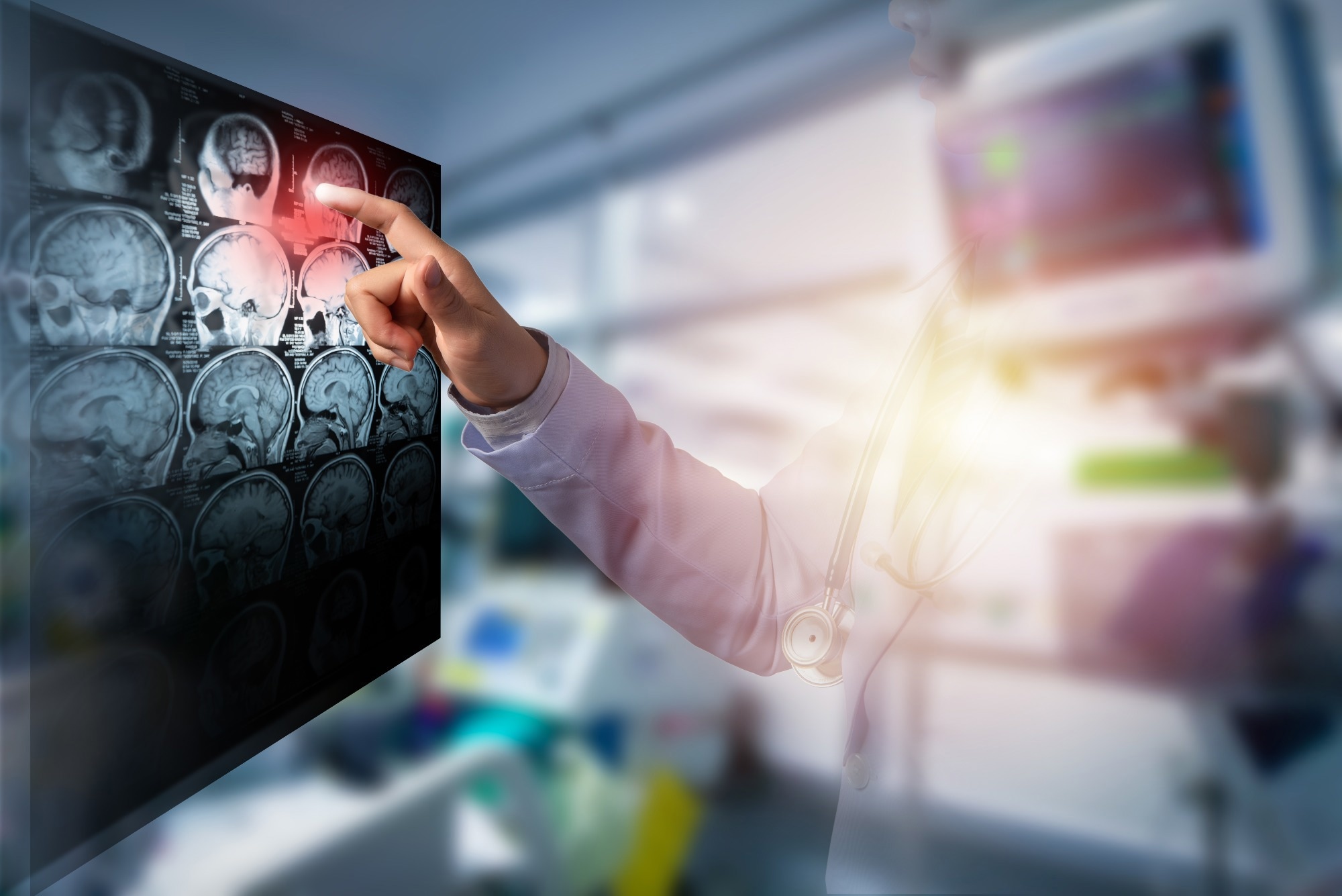 Study: Predicting Strokes with ML and XAI: A Transparent and Accurate Approach. Image credit: Tridsanu Thopet /Shutterstock