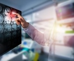 Predicting Strokes with ML and XAI: A Transparent and Accurate Approach