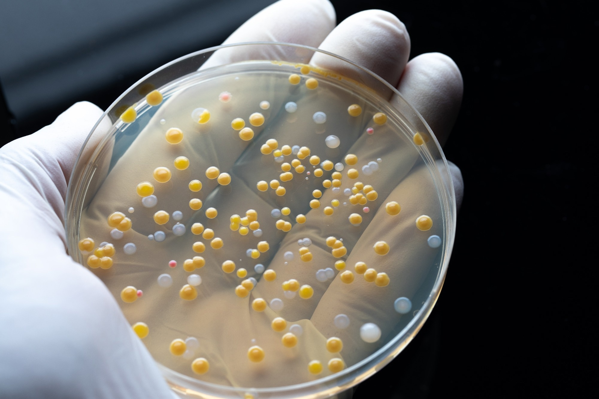 Research: Using genomic data and machine learning to predict antibiotic resistance: A tutorial paper. Image Credit: sruilk / Shutterstock