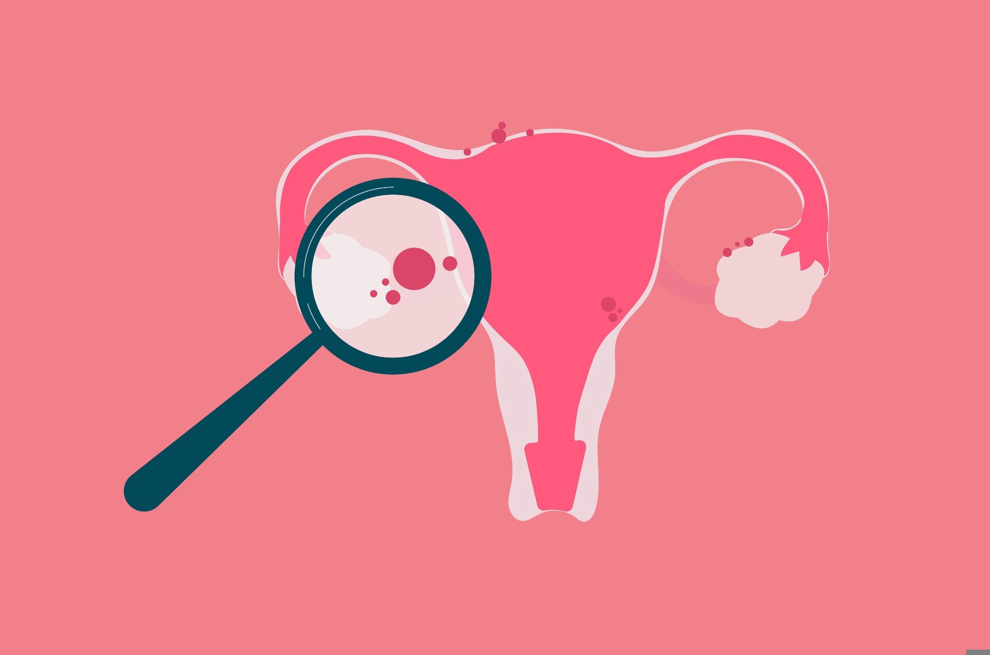 ​​​​​​​​​​​​​​Research: A comparative analysis of generative artificial intelligence responses from leading chatbots to questions about endometriosis. Image Credit: Gegambar / Shutterstock
