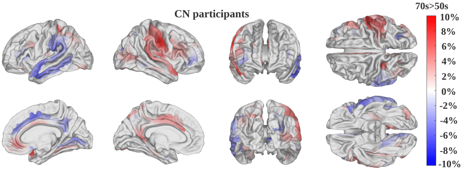 A saliency map produced by the new AI model displays the average difference in saliency between cognitively normal participants in their 50s and those in their 70s. Saliency highlights brain regions deemed by the deep neural network to be of greatest importance in estimating the pace of brain aging. Regions displayed in red reflect the pace of brain aging better in people who are in their 70s, while regions in blue better reflect brain aging speed in people in their 50s. (USC/Chenzhong Yin)