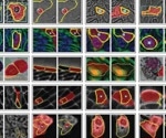 AI-Powered μSAM Speeds Up Microscopy Image Analysis Like Never Before