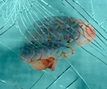 AI-Powered Forensic Tool Predicts Traumatic Brain Injuries with 94% Accuracy
