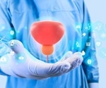 AI Predicts Prostate Cancer Treatment Success with 70% Greater Accuracy