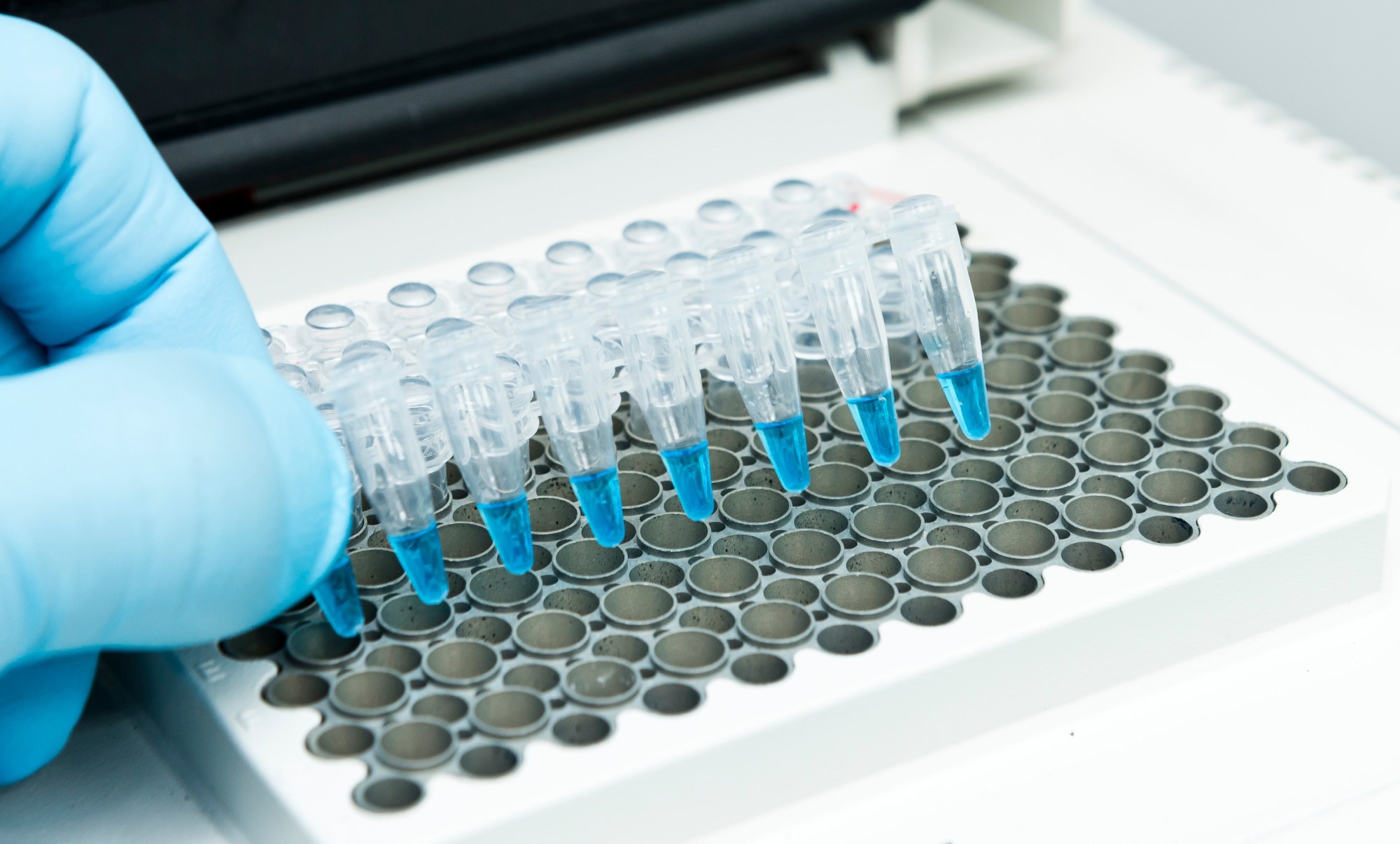 Research: scNET: learning context-specific gene and cell embeddings by integrating single-cell gene expression data with protein–protein interactions. Image Credit: unoL / Shutterstock