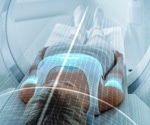 AI-Powered 3D Imaging Transforms Skin Cancer Surgery by Precisely Mapping Tumours