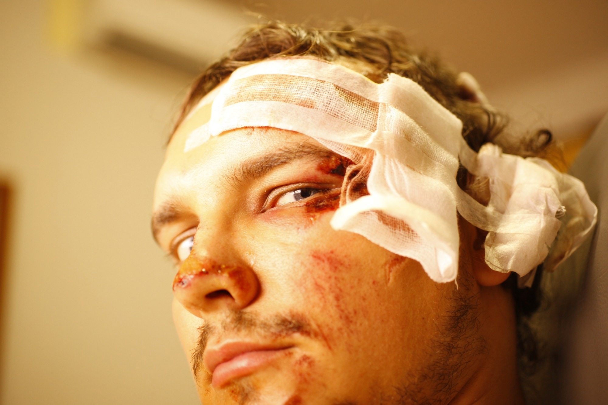 Research: A Machine Learning Model for Post-Concussion Musculoskeletal Injury Risk in Collegiate Athletes. Image Credit: krylova_nlp / Shutterstock