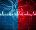 AI Pinpoints Irregular Heart Rhythms to Improve Atrial Fibrillation Treatment