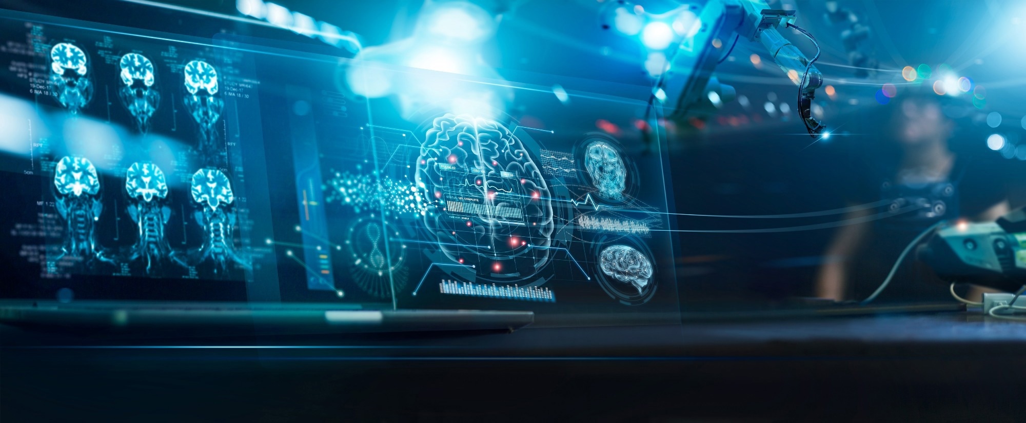 Study: AI-Enhanced Early Detection of Parkinson