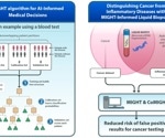New AI Method MIGHT Boosts Cancer Detection Accuracy While Reducing False Positives
