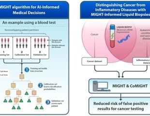 New AI Method MIGHT Boosts Cancer Detection Accuracy While Reducing False Positives