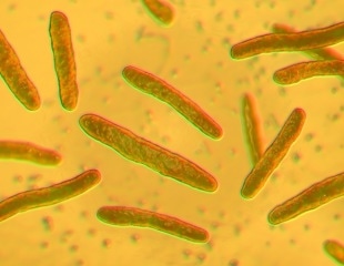 AI Tool Cracks How TB Drugs Kill Bacteria, Opening Door To Faster Treatments