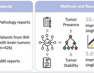 AI Unifies Radiology And Pathology Reports To Improve Brain Tumor Diagnosis And Prognosis