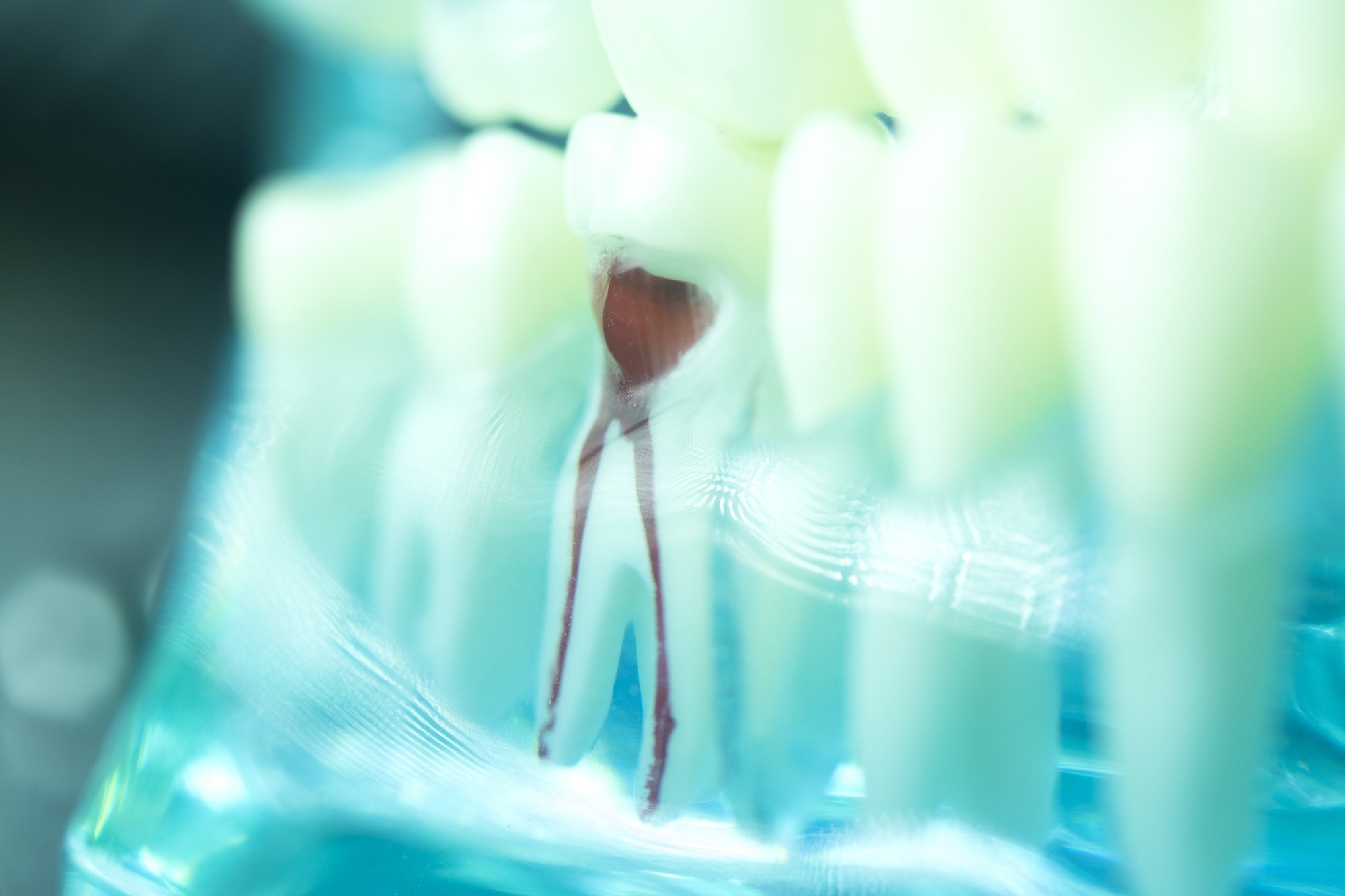 Study: Enhancing Non-Surgical Root Canal Treatment Prognoses with Machine Learning. Image credit: edwardolive/Shutterstock