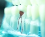 Enhancing Non-Surgical Root Canal Treatment Prognoses with Machine Learning
