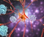 Revolutionary AI Tool 'CognoSpeak' Predicts Alzheimer's With Incredible Accuracy