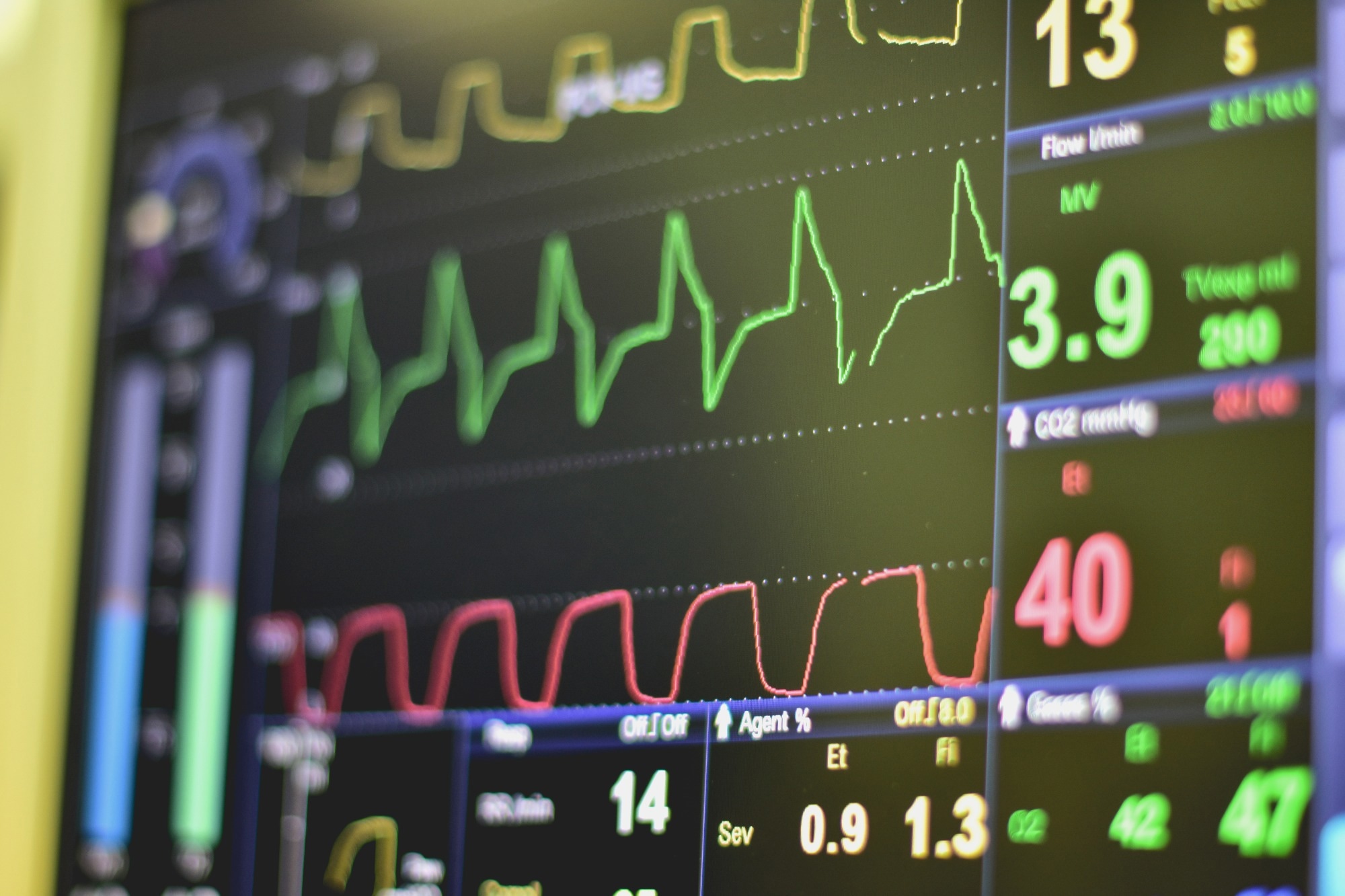 Study: AI Harnesses Individual Heartbeats for Early Detection of Cardiac Arrhythmias. Image credit: mr. teerapon tiuekhom/Shutterstock