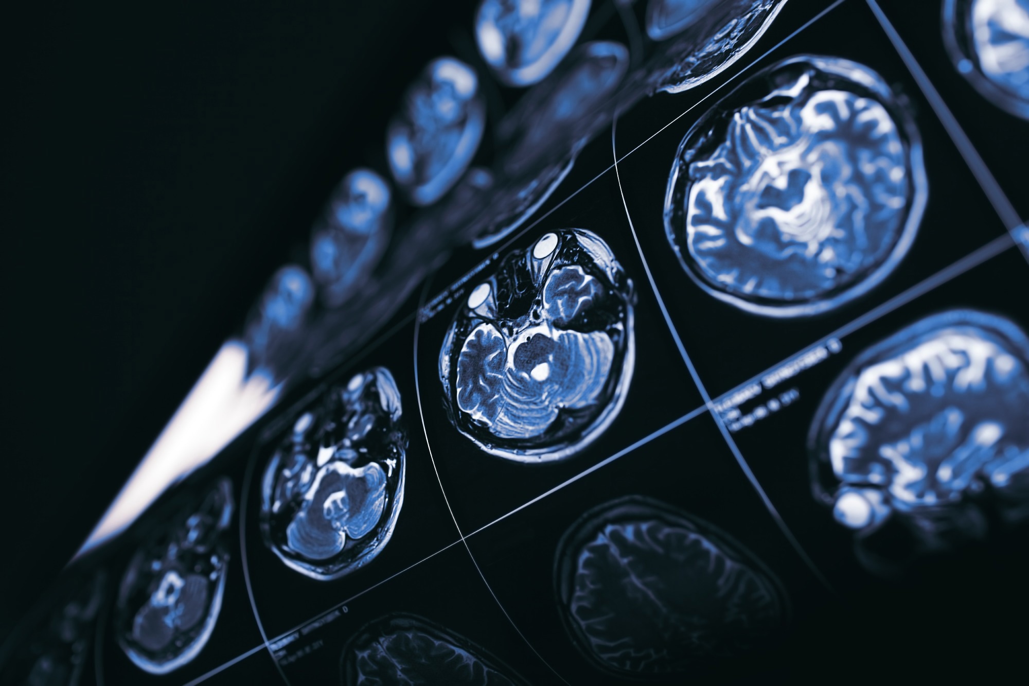 Study: AI-Crafted Novel Objects Shed Light on Brain Processing. Image credit: sfam_photo/Shutterstock